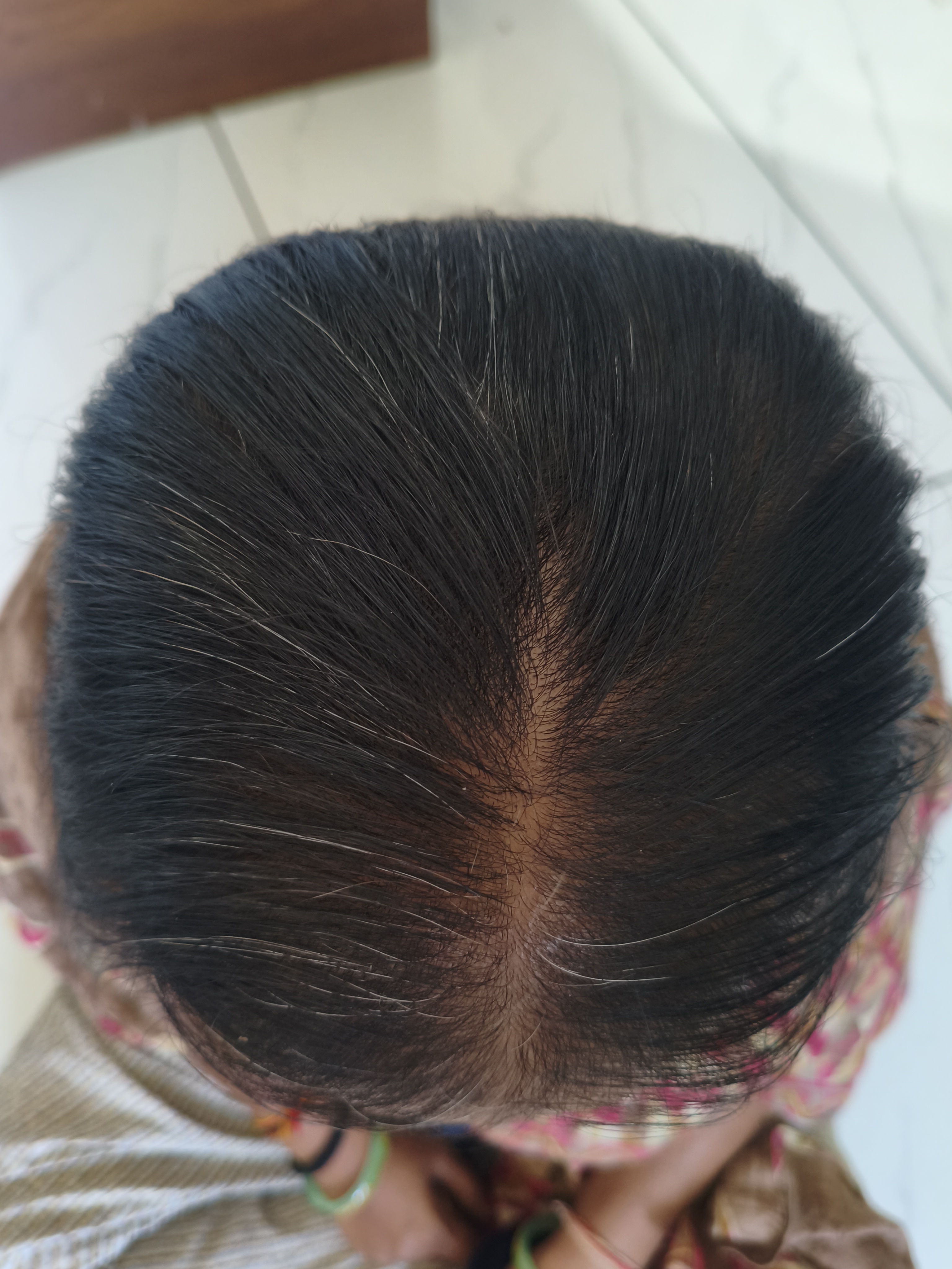 After