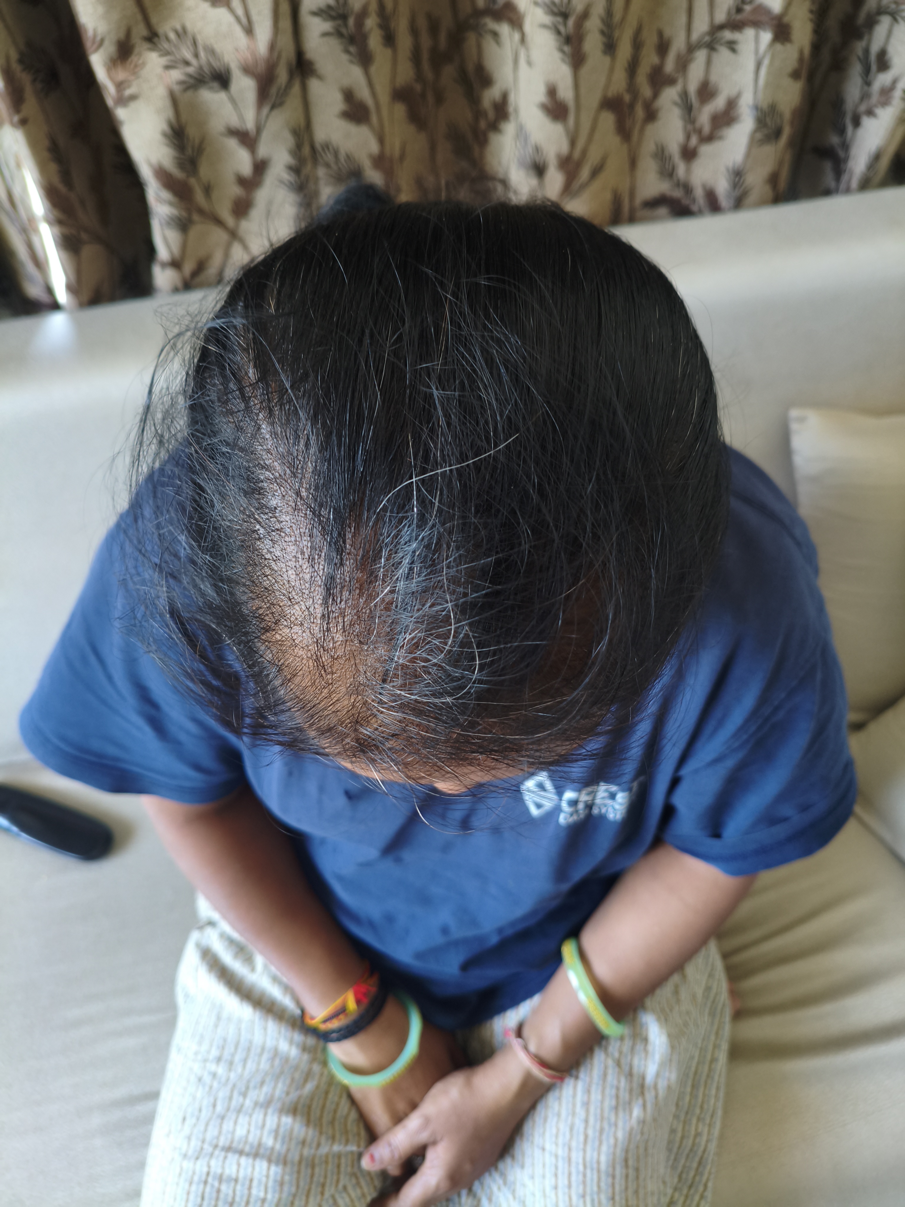 Before
